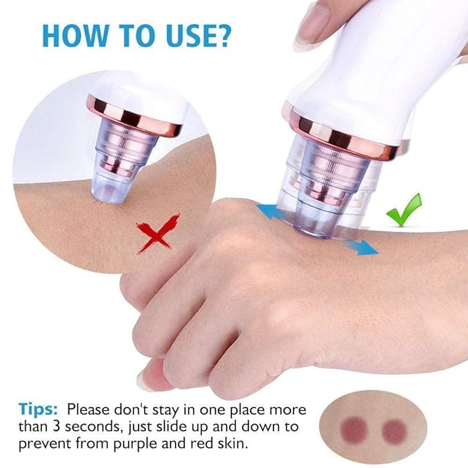 CalmFlex 6 in 1 Multi-function Blackhead Remover Tool