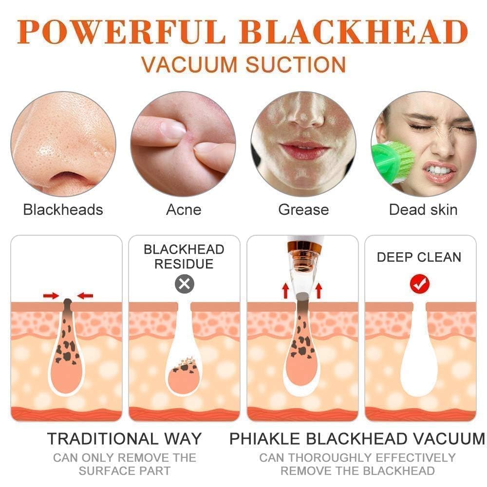CalmFlex 6 in 1 Multi-function Blackhead Remover Tool